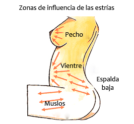 zonas-de-estrías